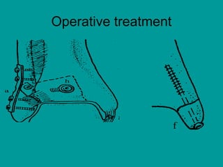 Operative treatment
 