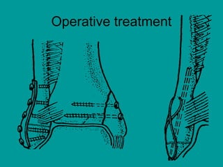 Operative treatment
 