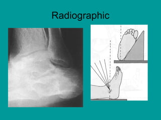 Radiographic
 
