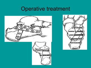 Operative treatment
 