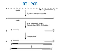 RT - PCR
 