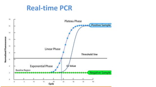Real-time PCR
 