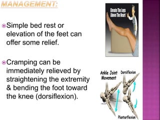 Simple bed rest or
elevation of the feet can
offer some relief.
Cramping can be
immediately relieved by
straightening the extremity
& bending the foot toward
the knee (dorsiflexion).
 