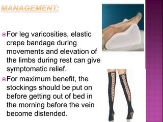 For leg varicosities, elastic
crepe bandage during
movements and elevation of
the limbs during rest can give
symptomatic relief.
For maximum benefit, the
stockings should be put on
before getting out of bed in
the morning before the veins
become distended.
 