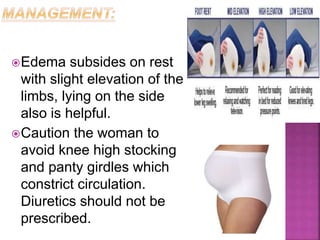Edema subsides on rest
with slight elevation of the
limbs, lying on the side
also is helpful.
Caution the woman to
avoid knee high stocking
and panty girdles which
constrict circulation.
Diuretics should not be
prescribed.
 