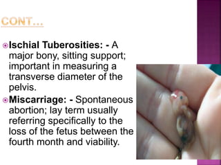 Ischial Tuberosities: - A
major bony, sitting support;
important in measuring a
transverse diameter of the
pelvis.
Miscarriage: - Spontaneous
abortion; lay term usually
referring specifically to the
loss of the fetus between the
fourth month and viability.
 