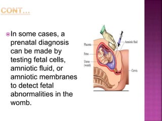 In some cases, a
prenatal diagnosis
can be made by
testing fetal cells,
amniotic fluid, or
amniotic membranes
to detect fetal
abnormalities in the
womb.
 