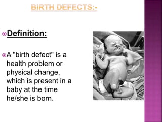 Definition:
A "birth defect" is a
health problem or
physical change,
which is present in a
baby at the time
he/she is born.
 