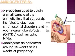 A procedure used to obtain
a small sample of the
amniotic fluid that surrounds
the fetus to diagnose
chromosomal disorders and
open neural tube defects
(ONTDs) such as spina
bifida.
Amniocentesis performed
around 15 weeks to 20
weeks of pregnancy.
 