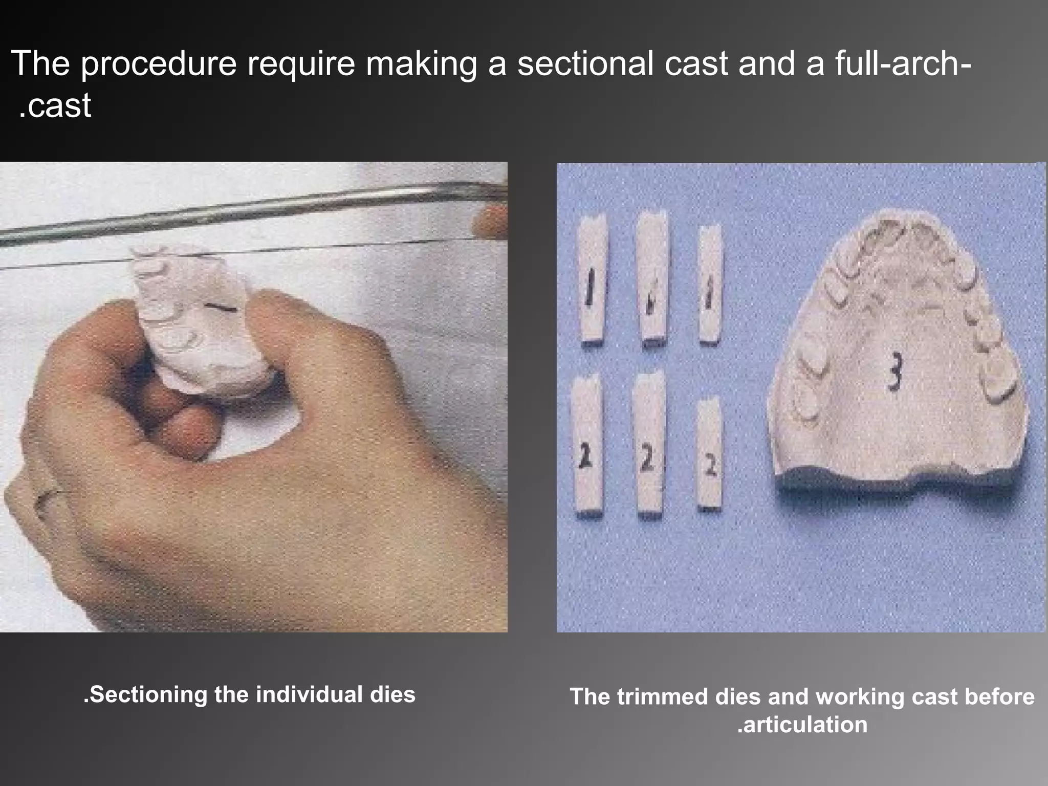 -The procedure require making a sectional cast and a full-arch
cast.
Sectioning the individual dies. The trimmed dies and working cast before
articulation.
 