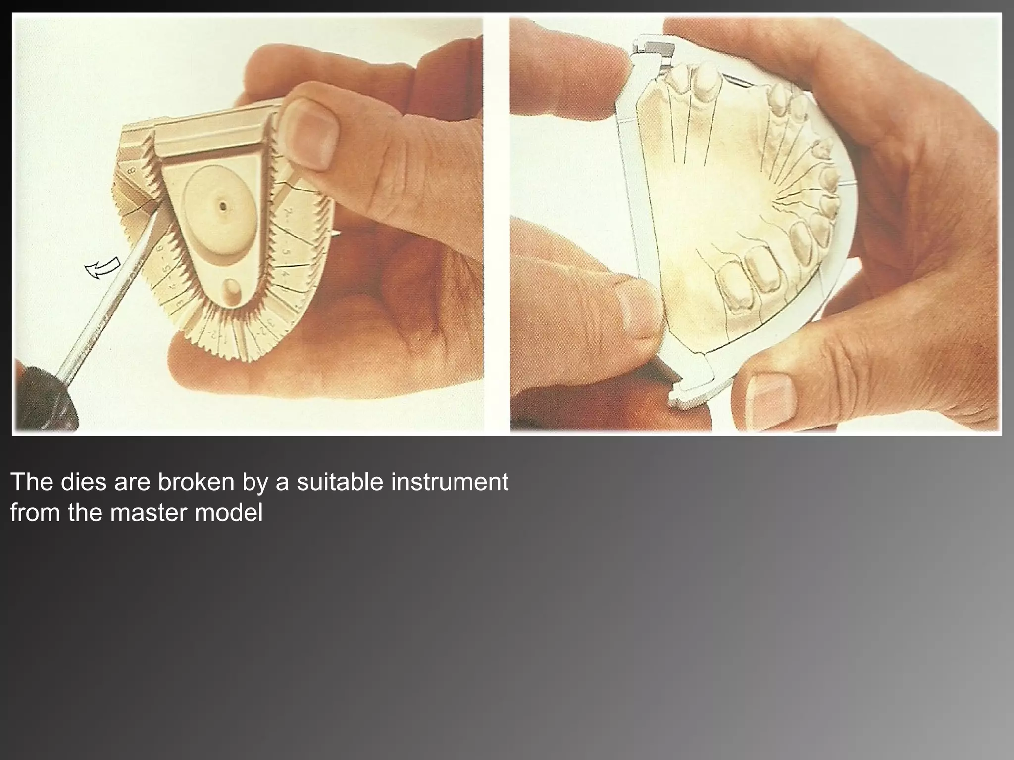 The dies are broken by a suitable instrument
from the master model
 