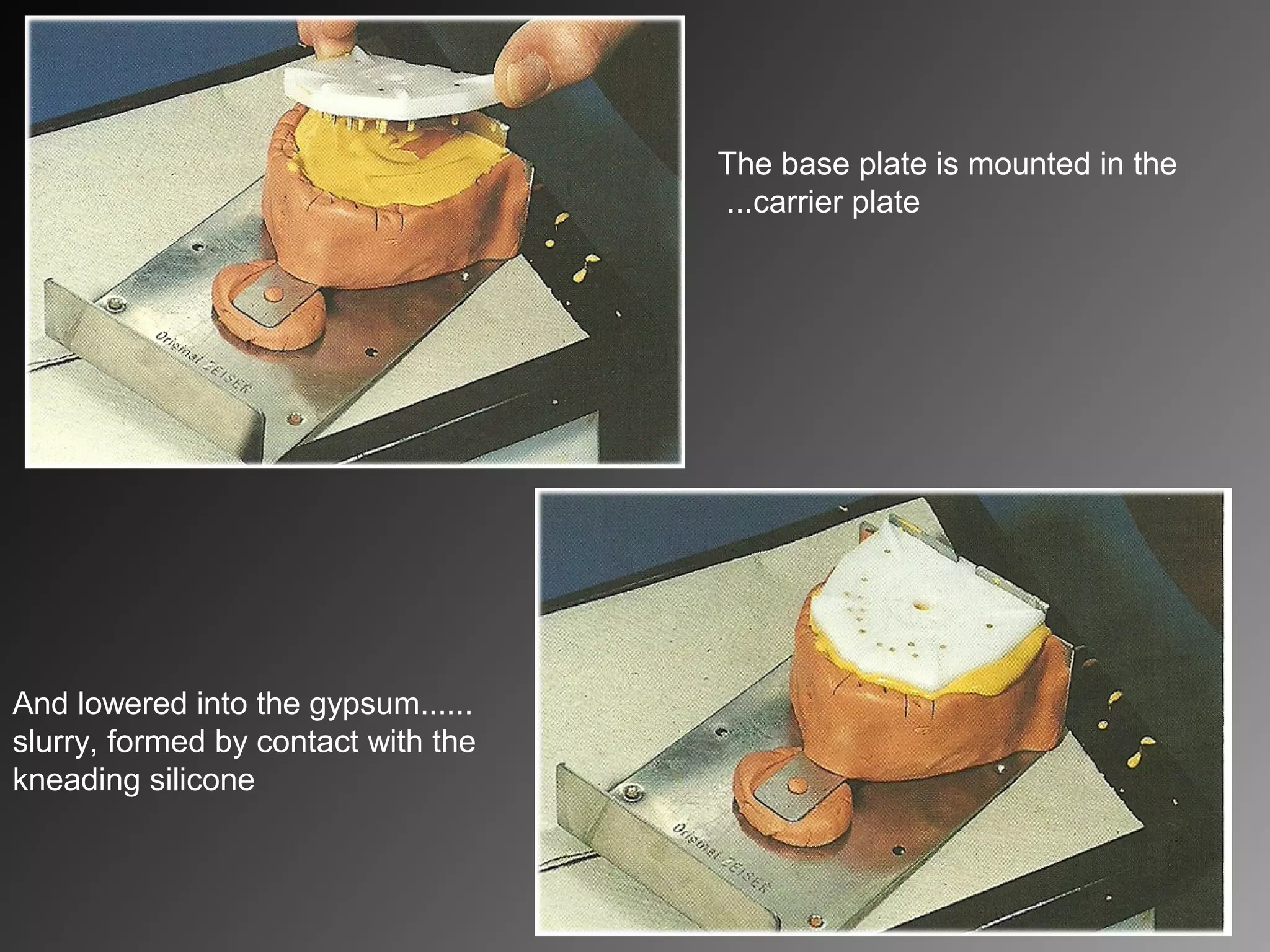 The base plate is mounted in the
carrier plate...
......And lowered into the gypsum
slurry, formed by contact with the
kneading silicone
 