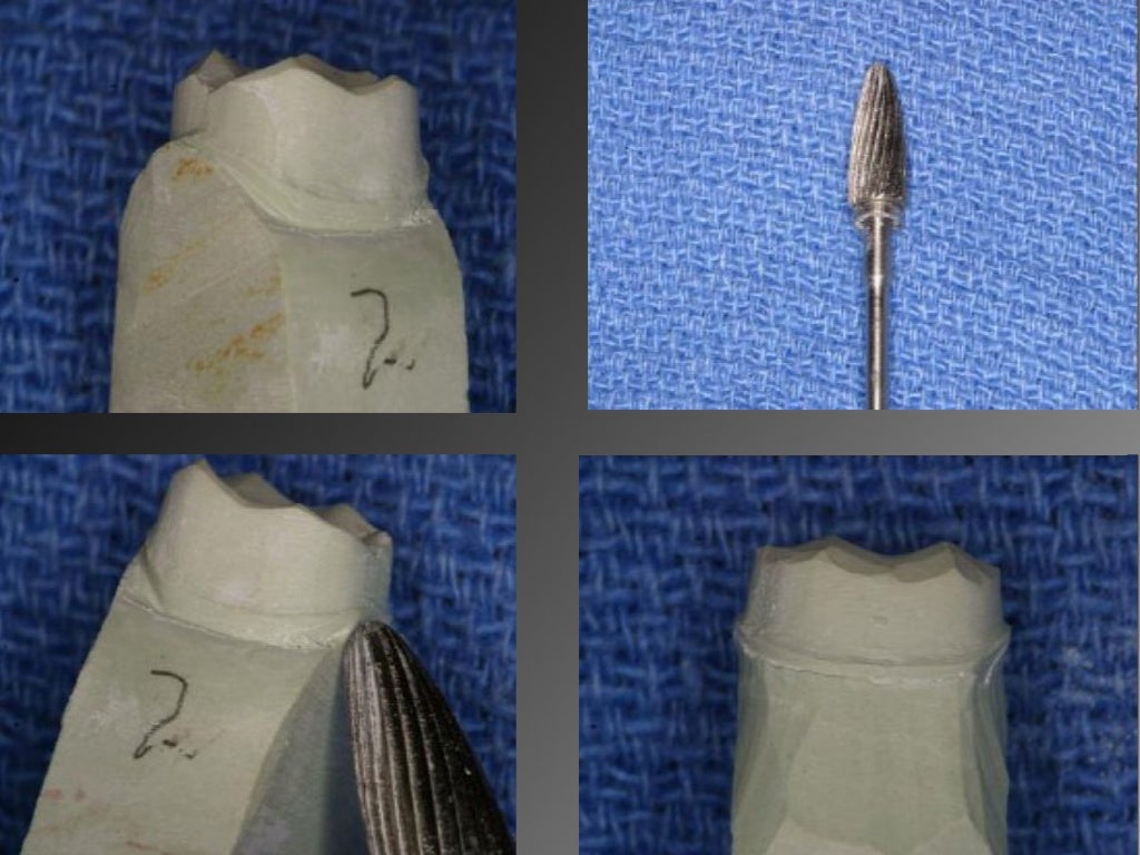 8.working casts and dies