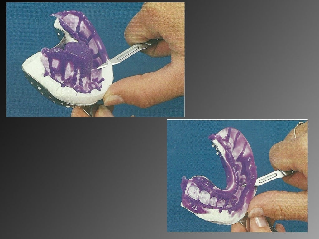 8.working casts and dies