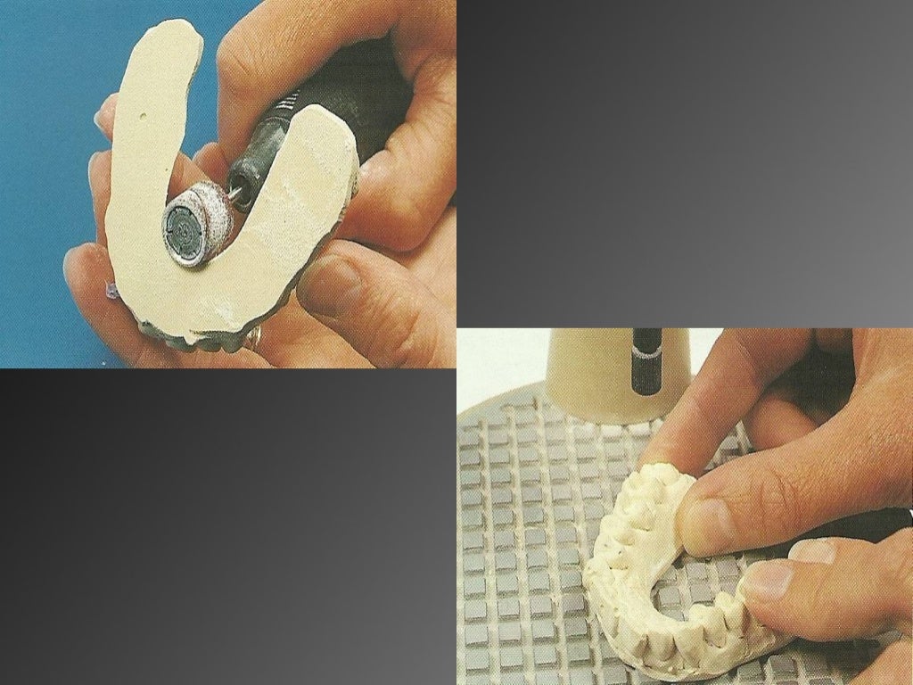 8.working casts and dies