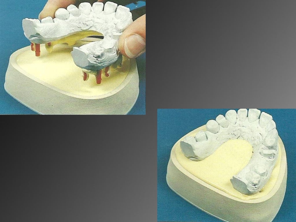 8.working casts and dies