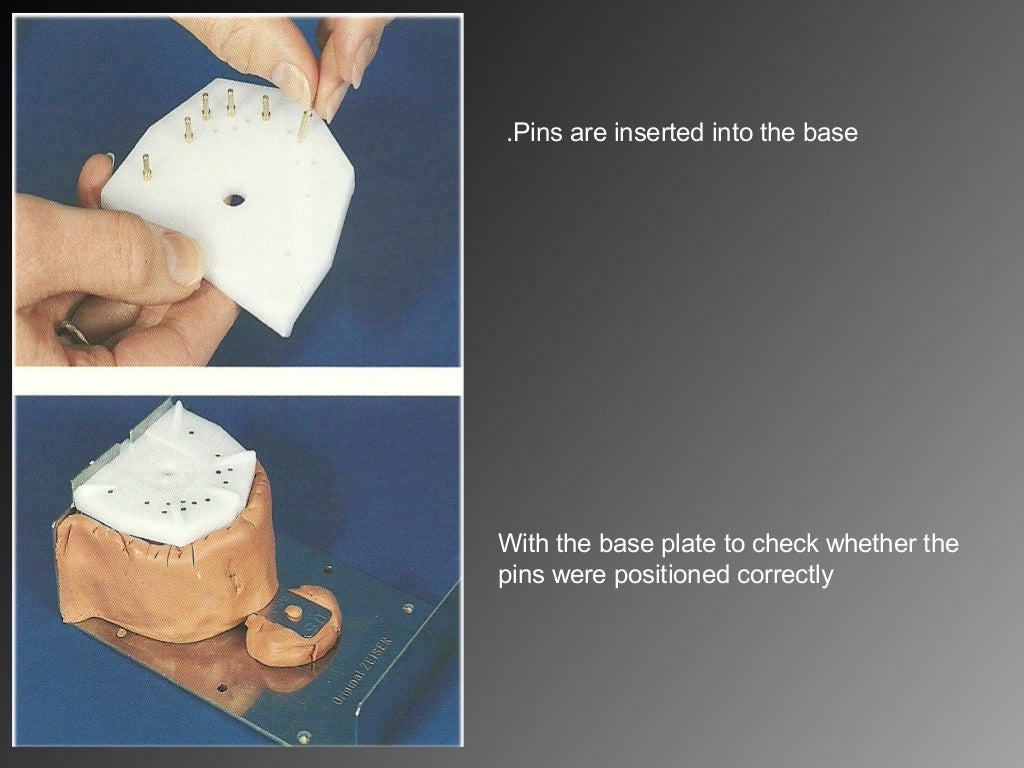 8.working casts and dies