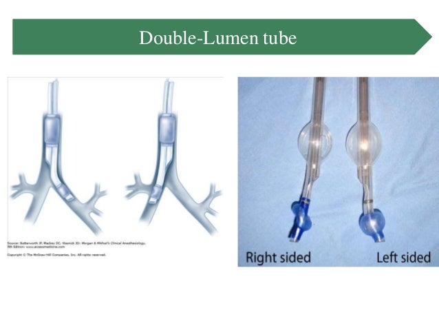 Airway management