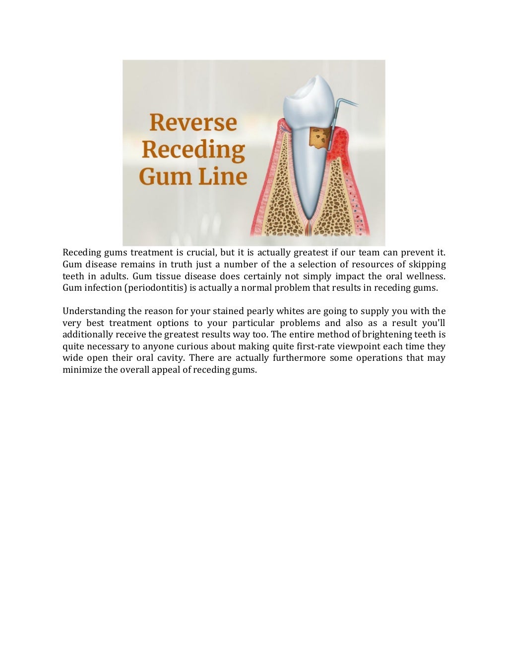Toothpaste For Receding Gums Treatment