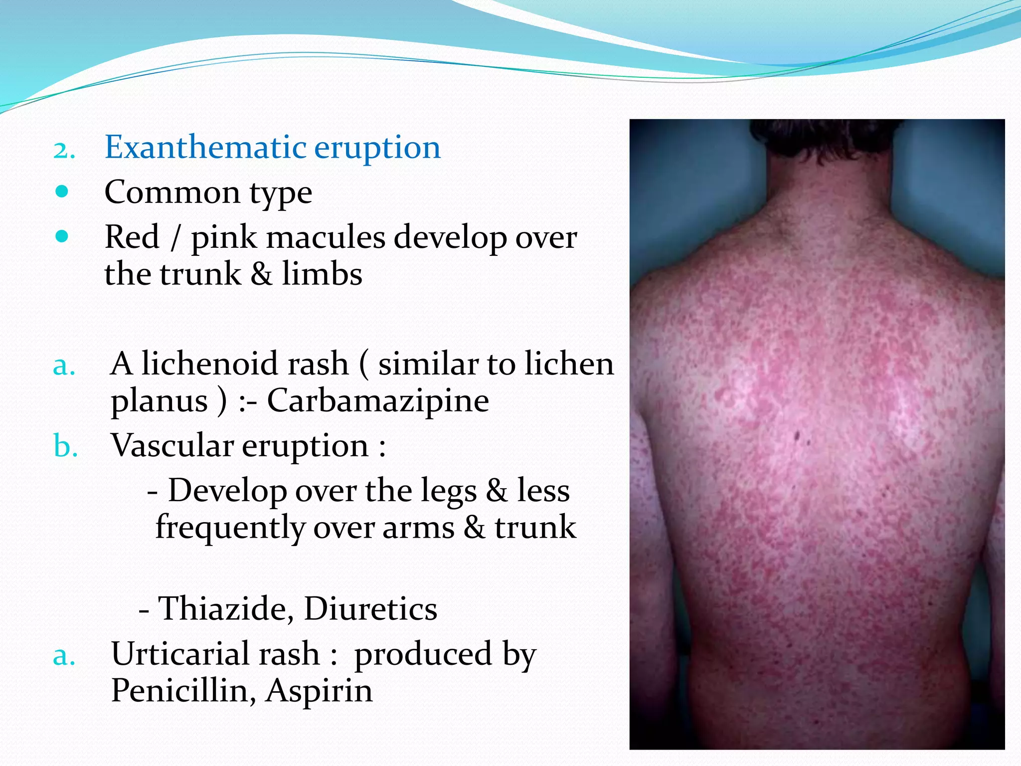 gabapentin drug eruption