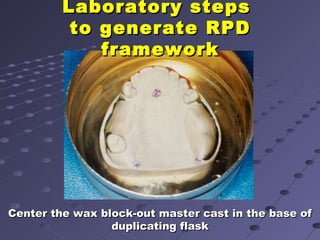 6. final impression techniques for removable partial dentures | PPT