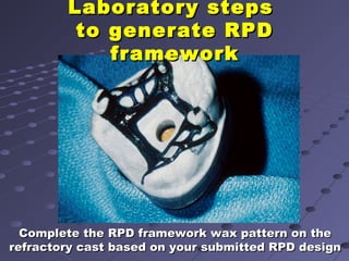 Beading Rpd 6. final impression techniques for removable partial dentures | PPT