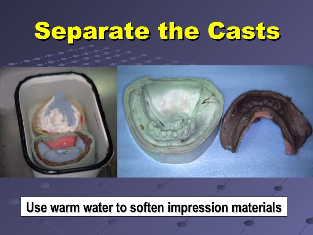 6. final impression techniques for removable partial dentures