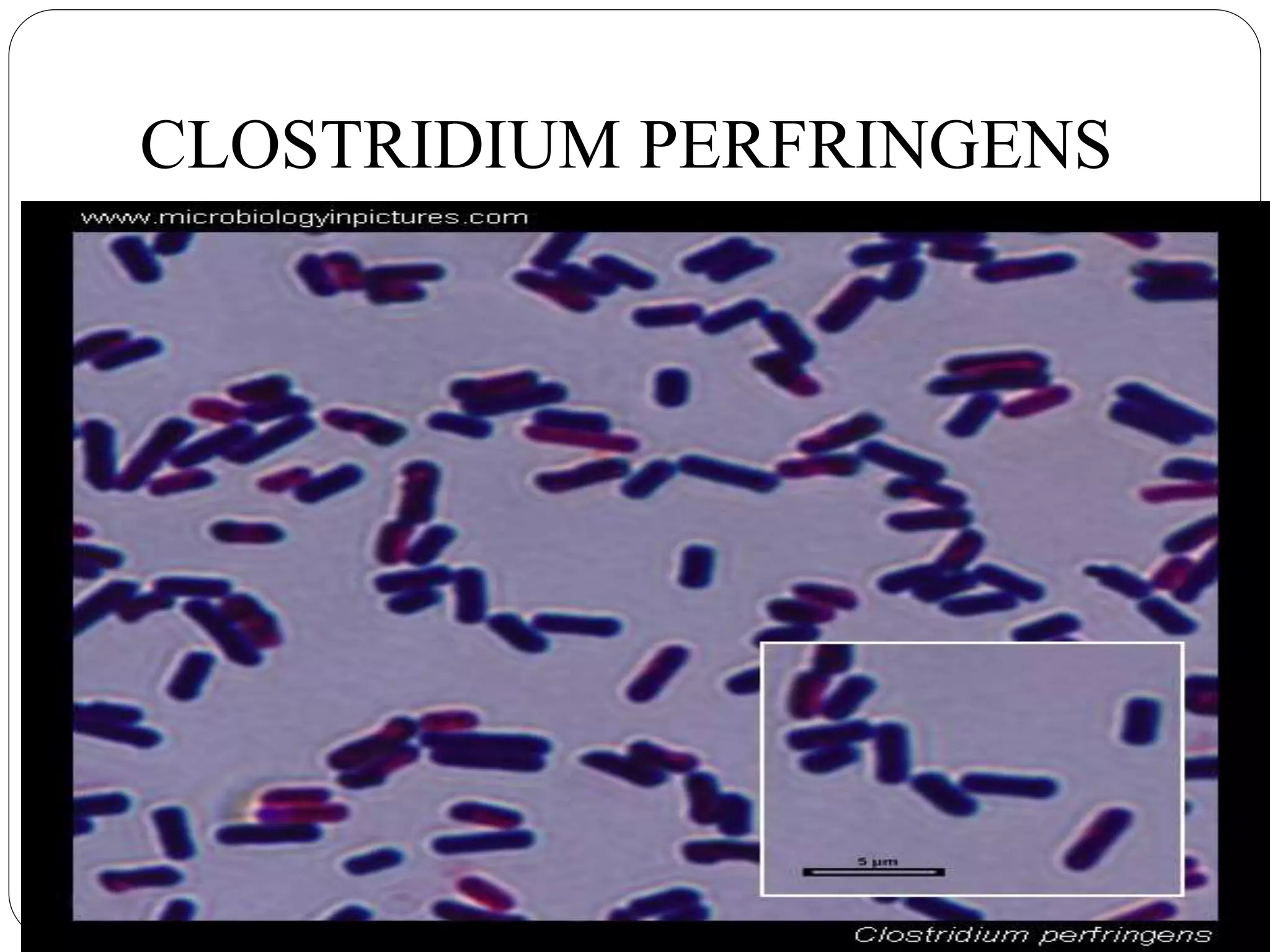 8 Clostridium Perfri PPTX 8-clostridium-perfri-pptx