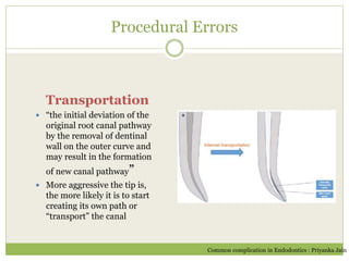 Procedural Errors
Transportation
 “the initial deviation of the
original root canal pathway
by the removal of dentinal
wall on the outer curve and
may result in the formation
of new canal pathway”
 More aggressive the tip is,
the more likely it is to start
creating its own path or
“transport” the canal
Common complication in Endodontics : Priyanka Jain
 