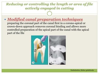 Reducing or controlling the length or area of file
actively engaged in cutting
 Modified canal preparation techniques
preparing the coronal part of the canal first in a corono-apical or
crown-down approach removes coronal binding and allows more
controlled preparation of the apical part of the canal with the apical
part of the file
Endodontics, Kishor gulabiwala
 