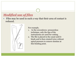 Modified use of files
 Files may be used in such a way that their area of contact is
reduced.
For example,
1. In the crowndown- pressureless
technique, only the tips of the
instruments are used for cutting.
2. The file is placed in the canal until it
binds and is then rotated twice without
apical pressure to remove dentine at
this binding point.
 