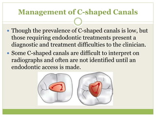 Management of C-shaped Canals
 Though the prevalence of C-shaped canals is low, but
those requiring endodontic treatments present a
diagnostic and treatment difficulties to the clinician.
 Some C-shaped canals are difficult to interpret on
radiographs and often are not identified until an
endodontic access is made.
 