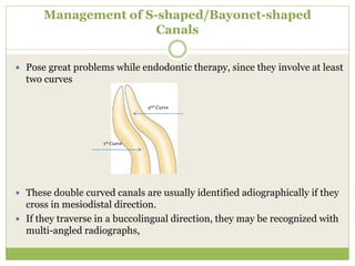 Management of S-shaped/Bayonet-shaped
Canals
 Pose great problems while endodontic therapy, since they involve at least
two curves
 These double curved canals are usually identified adiographically if they
cross in mesiodistal direction.
 If they traverse in a buccolingual direction, they may be recognized with
multi-angled radiographs,
2nd Curve
1st Curve
 
