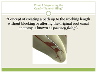 Phase I: Negotiating the
Canal—“Patency Filing”
“Concept of creating a path up to the working length
without blocking or altering the original root canal
anatomy is known as patency filing”.
 