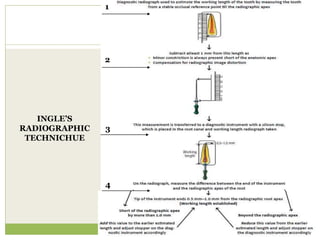 INGLE’S
RADIOGRAPHIC
TECHNICHUE
1
2
3
4
 