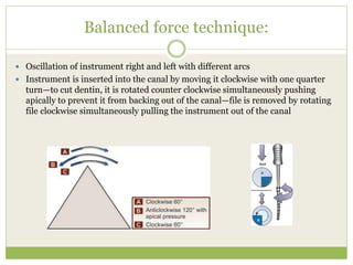 Balanced force technique:
 Oscillation of instrument right and left with different arcs
 Instrument is inserted into the canal by moving it clockwise with one quarter
turn—to cut dentin, it is rotated counter clockwise simultaneously pushing
apically to prevent it from backing out of the canal—file is removed by rotating
file clockwise simultaneously pulling the instrument out of the canal
 