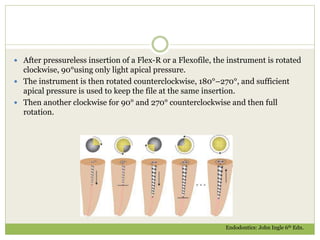  After pressureless insertion of a Flex-R or a Flexofile, the instrument is rotated
clockwise, 90°using only light apical pressure.
 The instrument is then rotated counterclockwise, 180°–270°, and sufficient
apical pressure is used to keep the file at the same insertion.
 Then another clockwise for 90° and 270° counterclockwise and then full
rotation.
Endodontics: John Ingle 6th Edn.
 