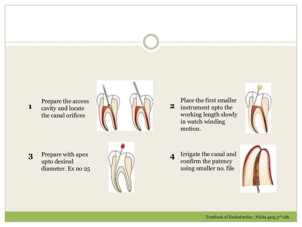 CLEANING AND SHAPING IN ENDODONTICS