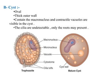 B- Cyst :-
•Oval
•Thick outer wall
•Contain the macronucleus and contractile vacuoles are
visible in the cyst .
•The cilia are undetectable , only the roots may present .
 