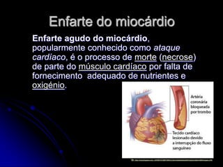 Enfarte do miocárdio
Enfarte agudo do miocárdio,
popularmente conhecido como ataque
cardíaco, é o processo de morte (necrose)
de parte do músculo cardíaco por falta de
fornecimento adequado de nutrientes e
oxigénio.




                        In: http://4.bp.blogspot.com/_CHVRD1H7d08/TOWVLa7Ae1I/AAAAAAAAAIE/Cjz2bmio0jA/s1600/imagem.JPG
 