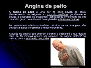 Angina de peito
A angina de peito é uma dor no peito devida ao baixo
abastecimento de oxigénio ao músculo cardíaco; geralmente é
devida à obstrução ou espasmos (contracções involuntária de um
músculo, grupo de músculos ou órgão) das artérias coronárias.

As doenças nas artérias coronárias, principal causa de angina, são
devidas a aterosclerose nas artérias coronárias.

Ataques de angina que ocorrem durante o descanso e que duram
mais de 15 minutos podem ser sintomas de angina instável ou
mesmo de um enfarte do miocárdio.




                                   In: http://www.arturmonteiro.com.br/wp-content/uploads/2010/04/emergencies_heart_attack.jpg
 
