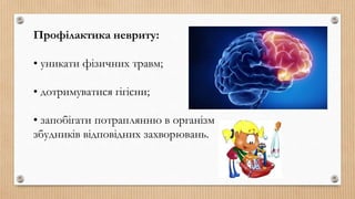 Профілактика невриту:
• уникати фізичних травм;
• дотримуватися гігієни;
• запобігати потраплянню в організм
збудників відповідних захворювань.
 