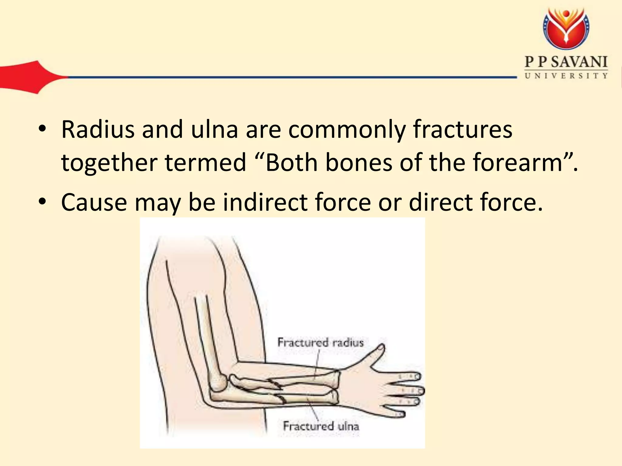 8. Forearm bone fractures | PPTX
