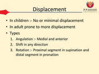 Displacement
• In children :- No or minimal displacement
• In adult prone to more displacement
• Types
1. Angulation :- Medial and anterior
2. Shift in any direction
3. Rotation :- Proximal segment in supination and
distal segment in pronation
 