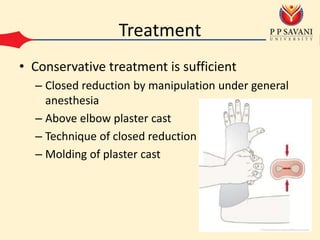 Treatment
• Conservative treatment is sufficient
– Closed reduction by manipulation under general
anesthesia
– Above elbow plaster cast
– Technique of closed reduction
– Molding of plaster cast
 