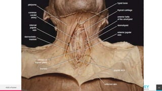 TREYresearch
Add a footer 12
 