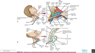 TREYresearch
Add a footer 53
 