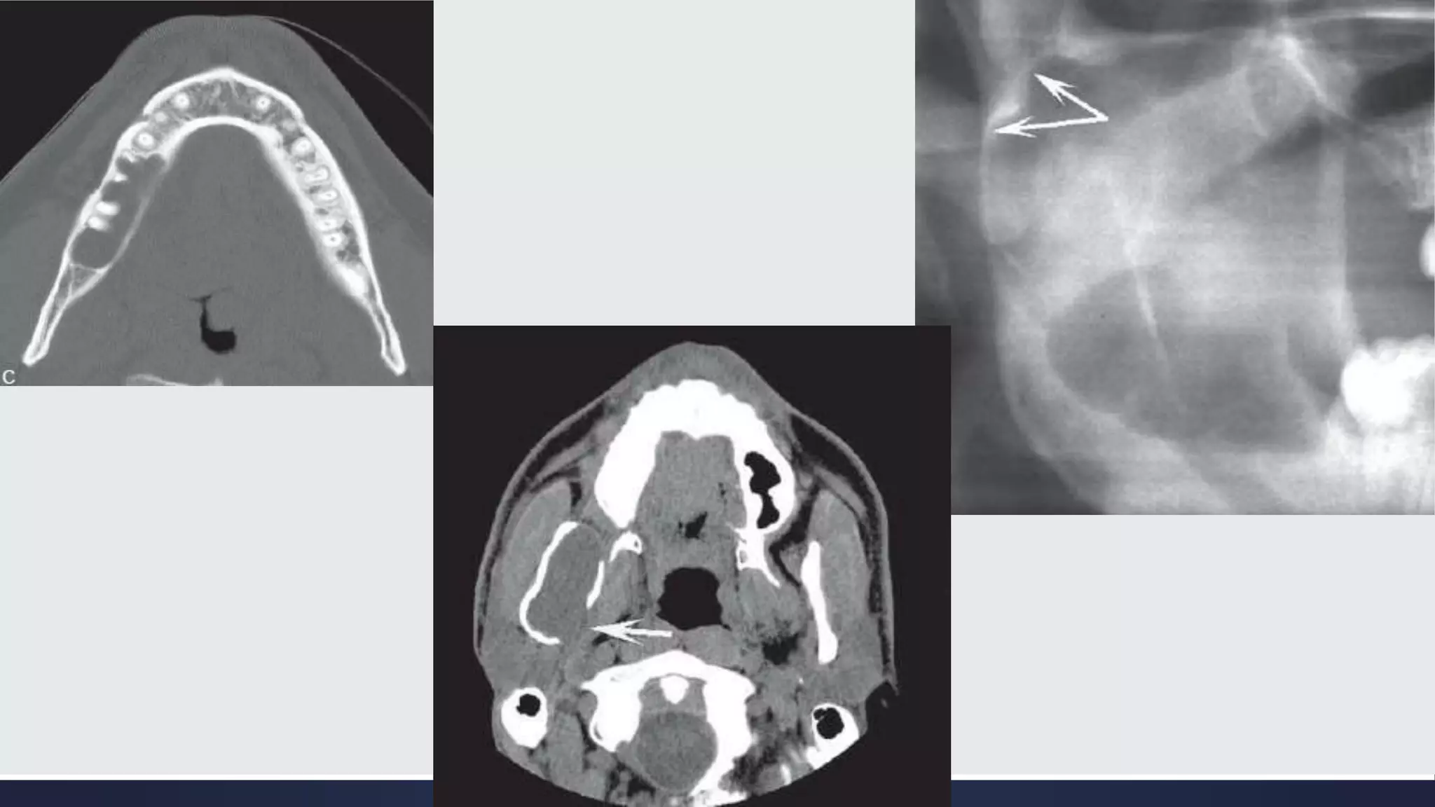 Radiographic Interpretation of Cyst and Cyst-like Lesions of the Jaws ...