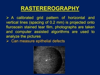 RASTEREROGRAPHY
 A calibrated grid pattern of horizontal and
vertical lines (spacing of 0.2 mm) is projected onto
fluroscein stained tear film, photographs are taken
and computer assisted algorithms are used to
analyze the pictures
 Can measure epithelial defects
 