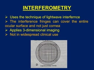 INTERFEROMETRY
 Uses the technique of lightwave interfernce
 The interference fringes can cover the entire
ocular surface and not just cornea
 Applies 3-dimensional imaging
 Not in widespread clinical use
 